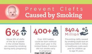 Cleft-lips caused by smoking infographic